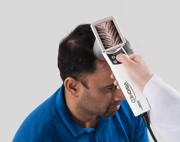 NOVO! PREGLED LASIŠČA Z HAIRMETRIX® IN TERAPIJA IZPADANJA LAS S POLINUKLEOTIDI